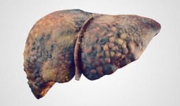 TGF-β途径中的血液生物标志物可识别隐藏的肝癌风险