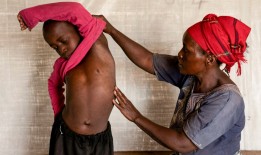 疾控中心和世卫组织考虑发出更强的麻疹警告