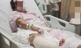 脑出血，腿部骨折：马西岭一名老妇人肇事逃逸，司机被捕