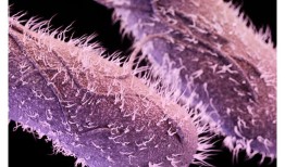 研究揭示了一些细菌感染是如何变成慢性的