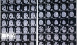 利用新型核技术治疗癌症患者