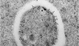 研究植物自噬：挑战和推荐的方法