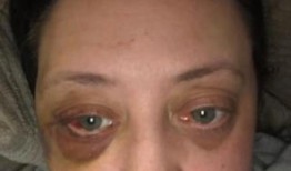 暴徒在暴力虐待后让受害者一直处于恐惧之中